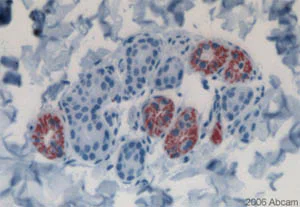 Immunohistochemistry (Formalin/PFA-fixed paraffin-embedded sections) - Anti-CD44 antibody [156-3C11] (AB16728)