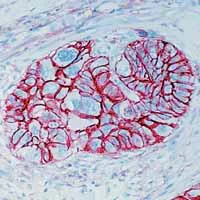 Immunohistochemistry (Formalin/PFA-fixed paraffin-embedded sections) - Anti-CD44 antibody [156-3C11] (AB16728)