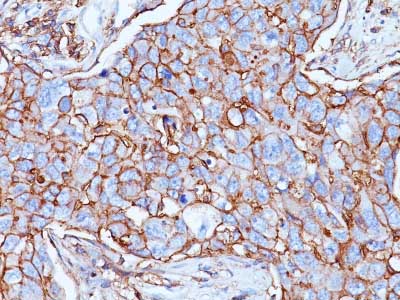 Immunohistochemistry (Formalin/PFA-fixed paraffin-embedded sections) - Anti-CD44 antibody [156-3C11] - BSA and Azide free (AB213072), expandable thumbnail