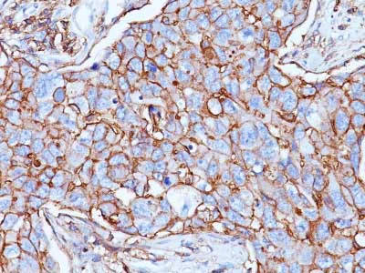 Immunohistochemistry (Formalin/PFA-fixed paraffin-embedded sections) - Anti-CD44 antibody [156-3C11] - BSA and Azide free (AB213072)