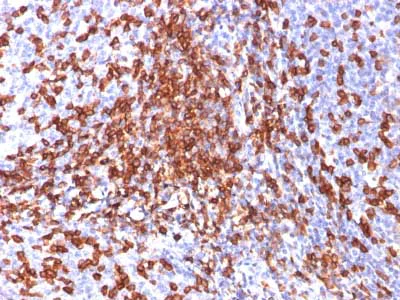 Immunohistochemistry (Formalin/PFA-fixed paraffin-embedded sections) - Anti-CD44 antibody [156-3C11] - BSA and Azide free (AB213072)