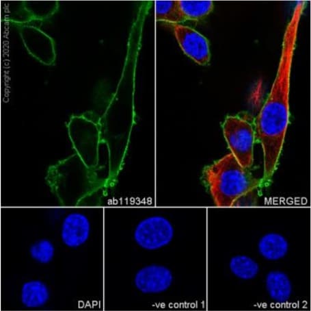 Immunocytochemistry/ Immunofluorescence - Anti-CD44 antibody [1M7.8.1] (AB119348), expandable thumbnail
