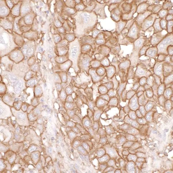 Immunohistochemistry (Formalin/PFA-fixed paraffin-embedded sections) - Anti-CD44 antibody (AB157107)