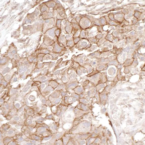 Immunohistochemistry (Formalin/PFA-fixed paraffin-embedded sections) - Anti-CD44 antibody (AB157107)