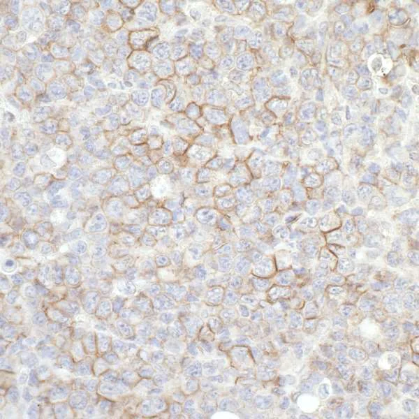 Immunohistochemistry (Formalin/PFA-fixed paraffin-embedded sections) - Anti-CD44 antibody (AB157107)
