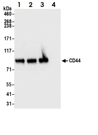 Immunoprecipitation - Anti-CD44 antibody (AB157107)
