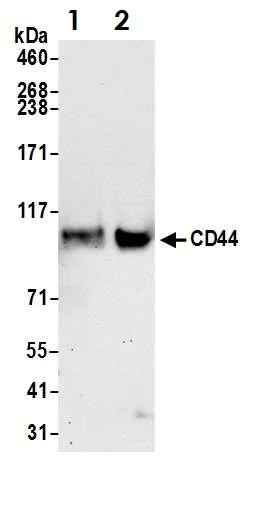 Western blot - Anti-CD44 antibody (AB157107)