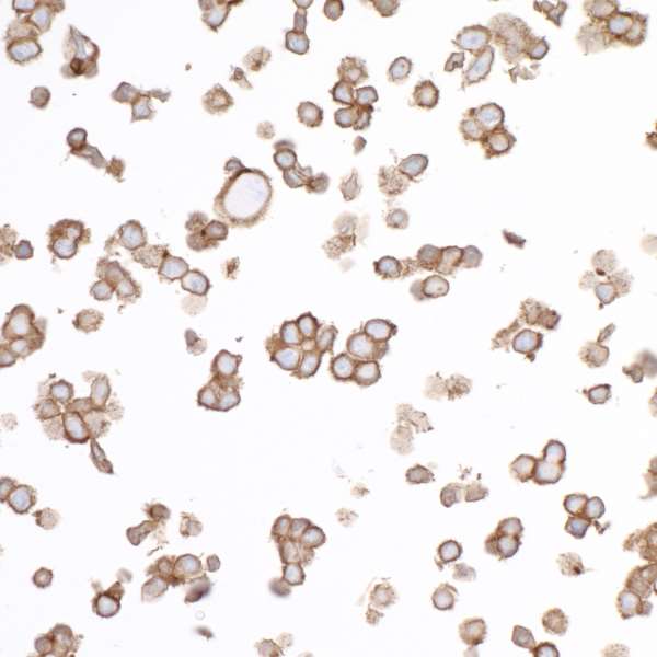 Immunocytochemistry - Anti-CD44 antibody [BLR038F] (AB243894), expandable thumbnail