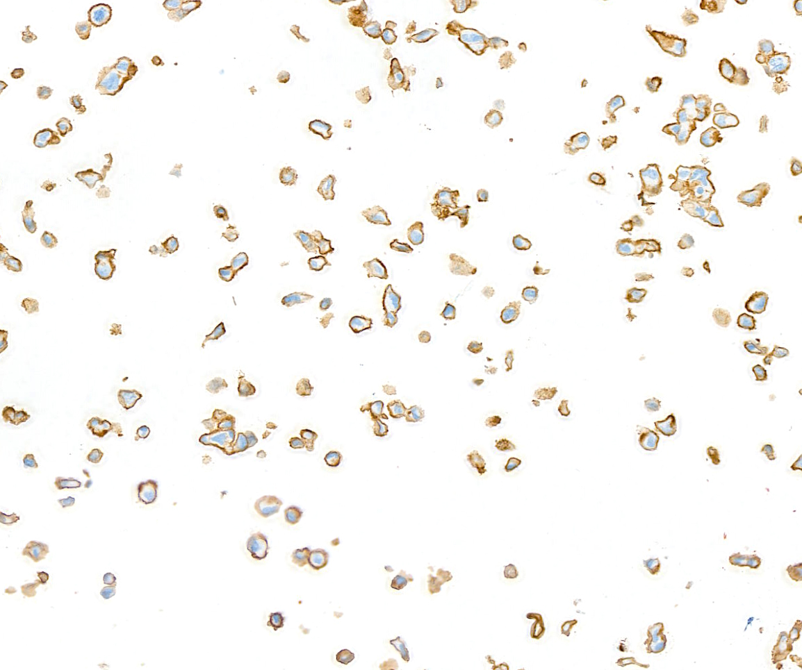 Immunocytochemistry - Anti-CD44 antibody [BLR038F] (ab243894), expandable thumbnail