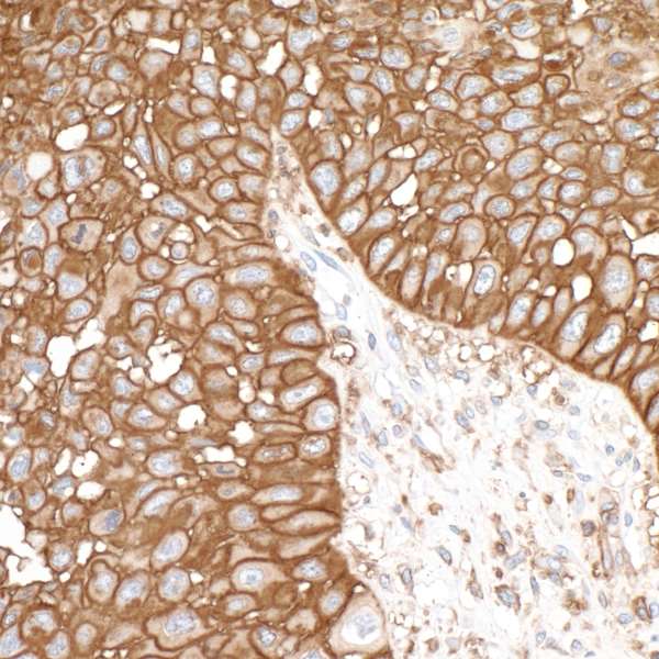Immunohistochemistry (Formalin/PFA-fixed paraffin-embedded sections) - Anti-CD44 antibody [BLR038F] (AB243894), expandable thumbnail