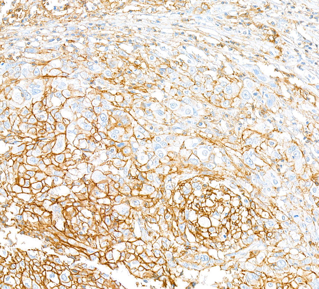 Immunohistochemistry (Formalin/PFA-fixed paraffin-embedded sections) - Anti-CD44 antibody [BLR038F] (ab243894), expandable thumbnail