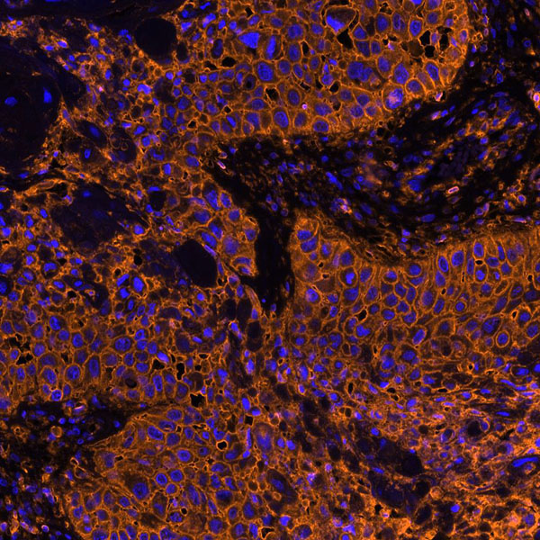Immunohistochemistry (Formalin/PFA-fixed paraffin-embedded sections) - Anti-CD44 antibody [BLR038F] (ab243894), expandable thumbnail