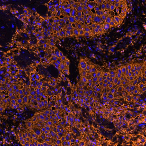 Immunohistochemistry (Formalin/PFA-fixed paraffin-embedded sections) - Anti-CD44 antibody [BLR038F] (AB243894)