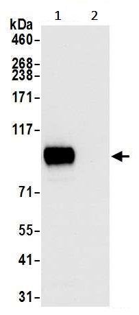 Immunoprecipitation - Anti-CD44 antibody [BLR038F] (AB243894), expandable thumbnail