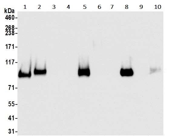 Western blot - Anti-CD44 antibody [BLR038F] (ab243894), expandable thumbnail