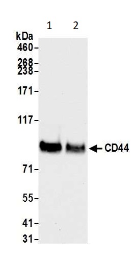Western blot - Anti-CD44 antibody [BLR038F] (ab243894), expandable thumbnail
