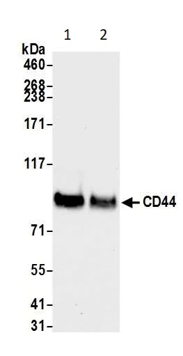 Western blot - Anti-CD44 antibody [BLR038F] (AB243894)
