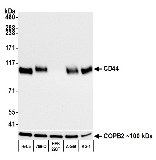 Western blot - Anti-CD44 antibody [BLR038F] (ab243894), expandable thumbnail