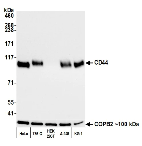 Western blot - Anti-CD44 antibody [BLR038F] (AB243894)