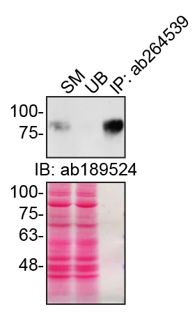 Immunoprecipitation - Anti-CD44 antibody [C44Mab-5] (AB264539)