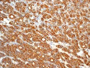 Immunohistochemistry (Formalin/PFA-fixed paraffin-embedded sections) - Anti-CD44 antibody [EPR1013Y] (ab51037), expandable thumbnail
