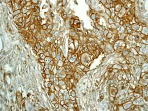 Immunohistochemistry (Formalin/PFA-fixed paraffin-embedded sections) - Anti-CD44 antibody [EPR1013Y] (ab51037), expandable thumbnail