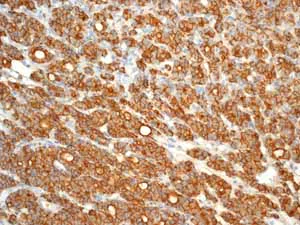Immunohistochemistry (Formalin/PFA-fixed paraffin-embedded sections) - Anti-CD44 antibody [EPR1013Y] - BSA and Azide free (AB216647)