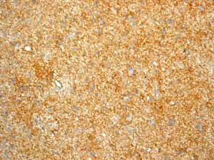 Immunohistochemistry (Formalin/PFA-fixed paraffin-embedded sections) - Anti-CD44 antibody [EPR1013Y] - BSA and Azide free (AB216647)