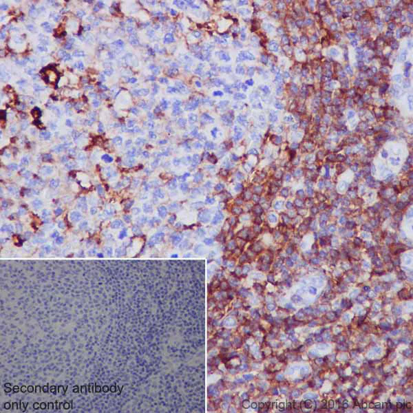 Immunohistochemistry (Formalin/PFA-fixed paraffin-embedded sections) - Anti-CD44 antibody [EPR1013Y] - BSA and Azide free (AB216647)
