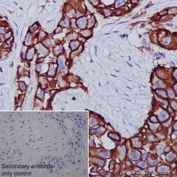 Immunohistochemistry (Formalin/PFA-fixed paraffin-embedded sections) - Anti-CD44 antibody [EPR1013Y] - Low endotoxin, Azide free (AB246690)