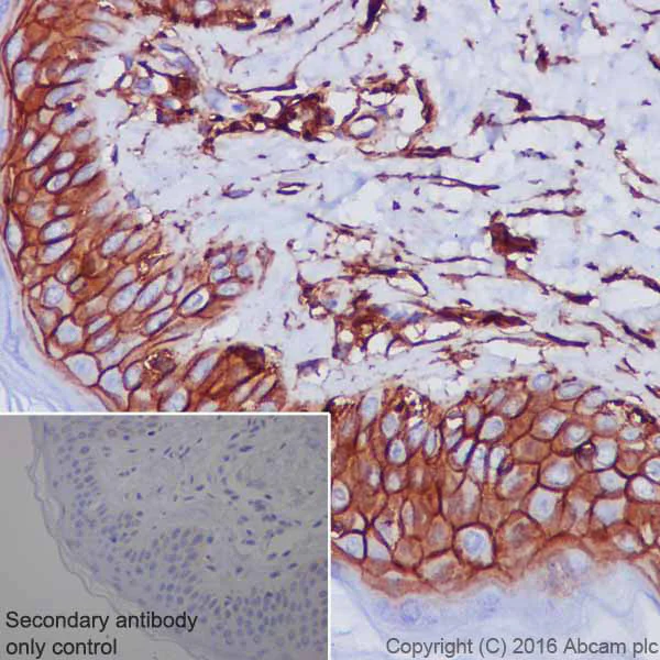 Immunohistochemistry (Formalin/PFA-fixed paraffin-embedded sections) - Anti-CD44 antibody [EPR1013Y] - Low endotoxin, Azide free (AB246690)