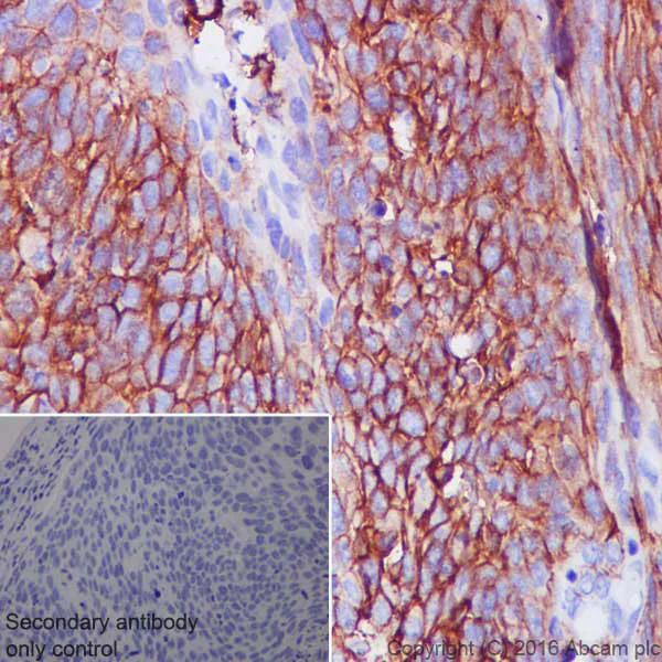 Immunohistochemistry (Formalin/PFA-fixed paraffin-embedded sections) - Anti-CD44 antibody [EPR1013Y] - Low endotoxin, Azide free (AB246690)