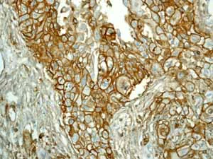 Immunohistochemistry (Formalin/PFA-fixed paraffin-embedded sections) - Anti-CD44 antibody [EPR1013Y] - Low endotoxin, Azide free (AB246690)