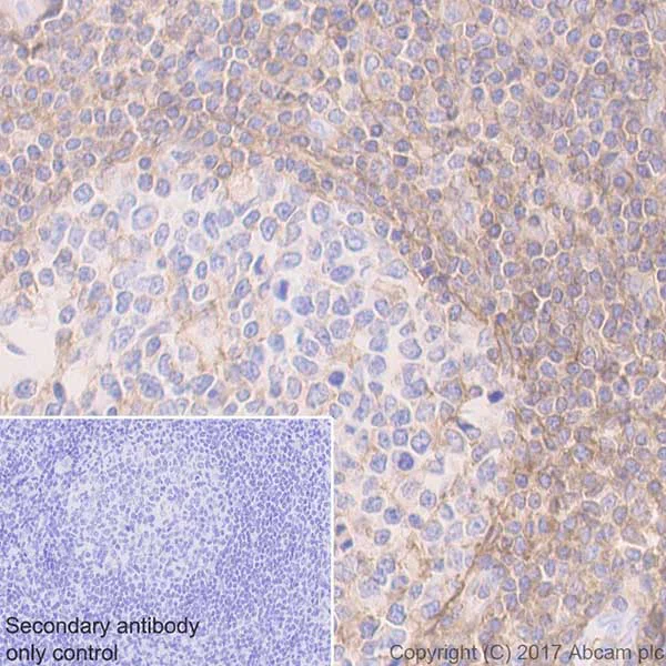 Immunohistochemistry (Formalin/PFA-fixed paraffin-embedded sections) - Anti-CD44 antibody [EPR18668] (AB189524)