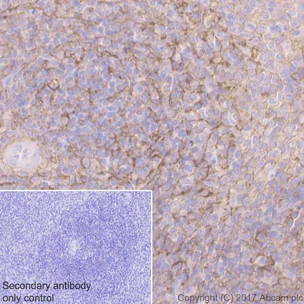 Immunohistochemistry (Formalin/PFA-fixed paraffin-embedded sections) - Anti-CD44 antibody [EPR18668] (AB189524)