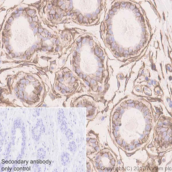 Immunohistochemistry (Formalin/PFA-fixed paraffin-embedded sections) - Anti-CD44 antibody [EPR18668] (AB189524)