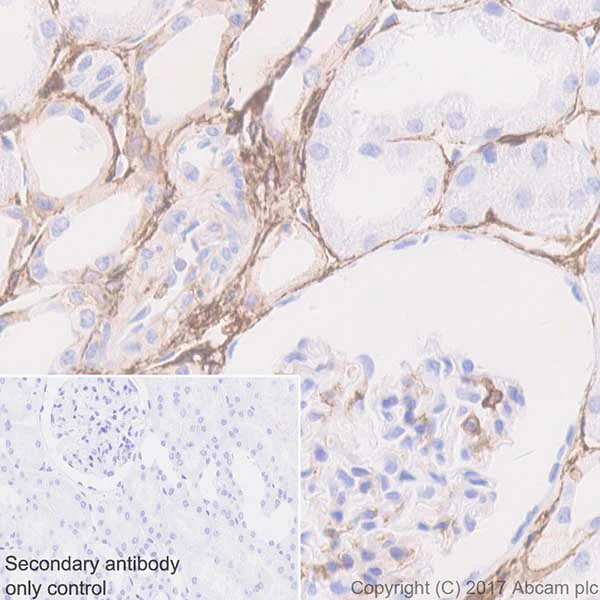 Immunohistochemistry (Formalin/PFA-fixed paraffin-embedded sections) - Anti-CD44 antibody [EPR18668] (AB189524)
