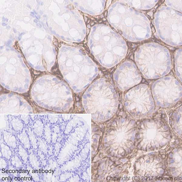 Immunohistochemistry (Formalin/PFA-fixed paraffin-embedded sections) - Anti-CD44 antibody [EPR18668] (AB189524)