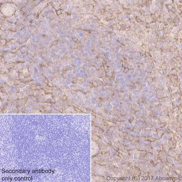 Immunohistochemistry (Formalin/PFA-fixed paraffin-embedded sections) - Anti-CD44 antibody [EPR18668] (AB189524)