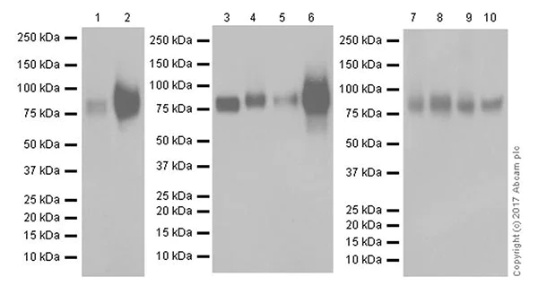 Western blot - Anti-CD44 antibody [EPR18668] (AB189524)