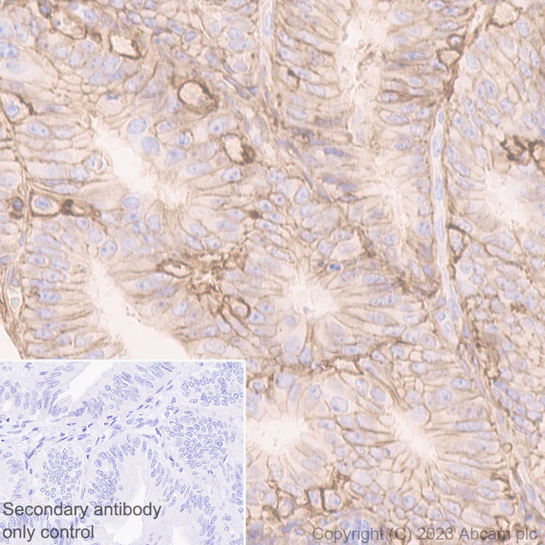 Immunohistochemistry (Formalin/PFA-fixed paraffin-embedded sections) - Anti-CD44 antibody [EPR18668] - BSA and Azide free (AB232556)