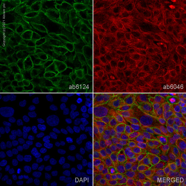 Immunocytochemistry/ Immunofluorescence - Anti-CD44 antibody [F10-44-2] (AB6124), expandable thumbnail