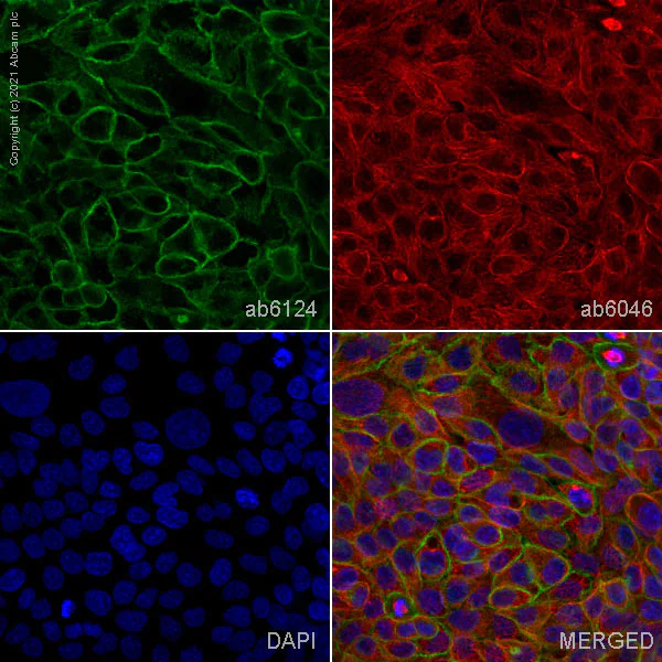 Anti-CD44 antibody [F10-44-2] (ab6124) | Abcam
