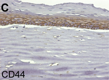 Immunohistochemistry (Formalin/PFA-fixed paraffin-embedded sections) - Anti-CD44 antibody [F10-44-2] (AB6124), expandable thumbnail