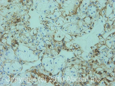 Immunohistochemistry (Formalin/PFA-fixed paraffin-embedded sections) - Anti-CD44 antibody [F10-44-2] (AB6124), expandable thumbnail