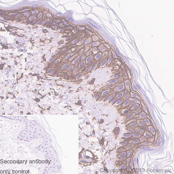 Immunohistochemistry (Formalin/PFA-fixed paraffin-embedded sections) - Anti-CD44 antibody [Hermes-3] (AB254530), expandable thumbnail