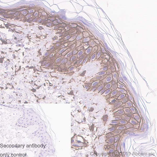 Immunohistochemistry (Formalin/PFA-fixed paraffin-embedded sections) - Anti-CD44 antibody [Hermes-3] (AB254530)