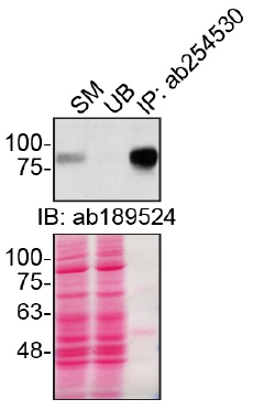 Immunoprecipitation - Anti-CD44 antibody [Hermes-3] (AB254530), expandable thumbnail