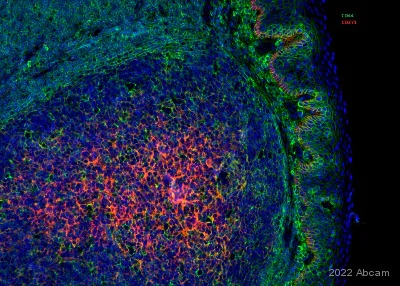 Immunohistochemistry (Formalin/PFA-fixed paraffin-embedded sections) - Anti-CD44 antibody [Hermes-3] - BSA and Azide free (AB255946)