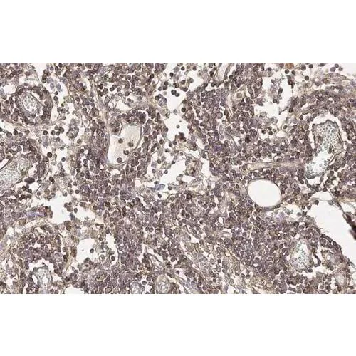 Immunohistochemistry (Formalin/PFA-fixed paraffin-embedded sections) - Anti-CD44 antibody [HL1650] (AB317102)